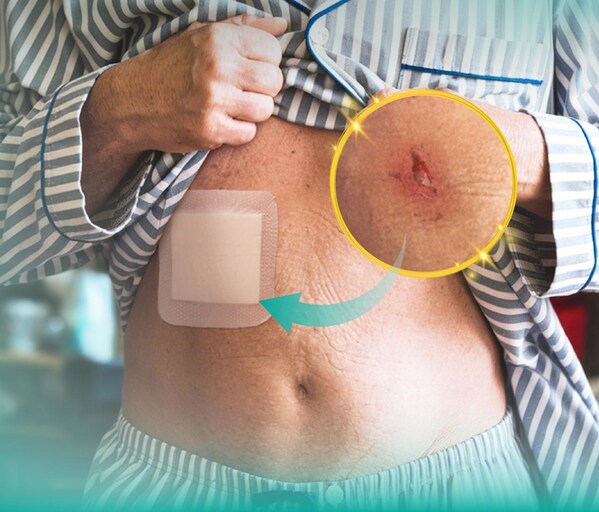Wounds hard to heal? Troubled by dressing changes? Dimora, Amazon's 3-year top brand, shows you the way.