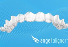 Paris Court Ruling on Discontinued Feature Will Have Minimal Impact on Angelalign Customers